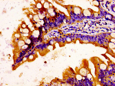 IHC image of CSB-PA003648LA01HU diluted at 1:100 and staining in paraffin-embedded human small intestine tissue performed on a Leica BondTM system. After dewaxing and hydration, antigen retrieval was mediated by high pressure in a citrate buffer (...