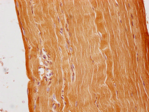 IHC image of CSB-PA003654PA01HU diluted at 1:100 and staining in paraffin-embedded human skeletal muscle tissue performed on a Leica BondTM system. After dewaxing and hydration, antigen retrieval was mediated by high pressure in a citrate buffer (...