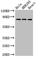 Western Blot Positive WB detected in: Hela whole cell lysate, HEK293 whole cell lysate, Rat heart tissue All lanes: C1R antibody at 3ug/ml Secondary Goat polyclonal to rabbit IgG at 1/50000 dilution Predicted band size: 81 kDa Observed band size:...