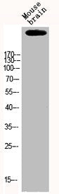Western Blot analysis of MOUSE-BRAIN cells using p300 Polyclonal Antibody
