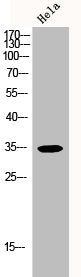 Western Blot analysis of HELA cells using p35 Polyclonal Antibody