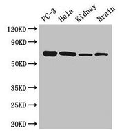 Western Blot Positive WB detected in: PC-3 whole cell lysate, Hela whole cell lysate, Mouse kidney tissue, Mouse brain tissue All lanes: GPI antibody at 2.7µg/ml Secondary Goat polyclonal to rabbit IgG at 1/50000 dilution Predicted band size: 64,...