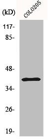 Western Blot analysis of COLO205 cells using p53R2 Polyclonal Antibody