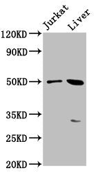 Western Blot Positive WB detected in: Jurkat whole cell lysate, Mouse liver tissue All lanes: BPIFB3 antibody at 3.8µg/ml Secondary Goat polyclonal to rabbit IgG at 1/50000 dilution Predicted band size: 51 kDa Observed band size: 51 kDa