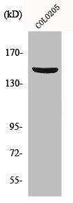 Western Blot analysis of COLO205 cells using PARD3A Polyclonal Antibody