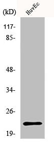 Western Blot analysis of HuvEc cells using PARK7 Polyclonal Antibody