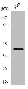 Western Blot analysis of Jurkat cells using PDHA1 Polyclonal Antibody