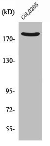 Western Blot analysis of COLO205 cells using PDZ-RhoGEF Polyclonal Antibody