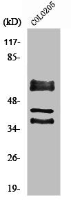 Western Blot analysis of 293 cells using Periphilin 1 Polyclonal Antibody