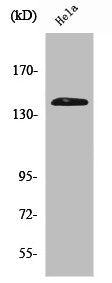Western Blot analysis of Hela cells using PERK Polyclonal Antibody