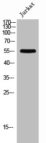 Western Blot analysis of Jurkat cells using PFK-2 liv Polyclonal Antibody