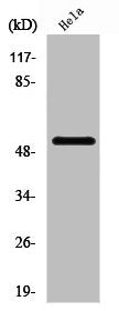 Western Blot analysis of 293 cells using PFK-2 liv/tes Polyclonal Antibody