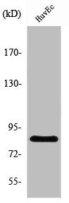 Western Blot analysis of HuvEc cells using Photomedin-2 Polyclonal Antibody