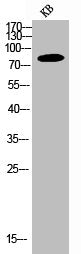 Western Blot analysis of KB cells using PI 3-kinase p85α Polyclonal Antibody