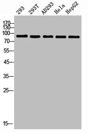 Western Blot analysis of 453 293 AD293 HELA HepG2 cells using PI 3-kinase p85α Polyclonal Antibody