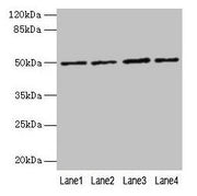 Western blot All lanes: EVA1C antibody at 5µg/ml Lane 1: Hela whole cell lysate Lane 2: Jurkat whole cell lysate Lane 3: 293T whole cell lysate Lane 4: HL60 whole cell lysate Secondary Goat polyclonal to rabbit IgG at 1/10000 dilution Predicted ba...