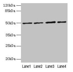 Western blot All lanes: EVA1C antibody at 5µg/ml Lane 1: Hela whole cell lysate Lane 2: Jurkat whole cell lysate Lane 3: 293T whole cell lysate Lane 4: HL60 whole cell lysate Secondary Goat polyclonal to rabbit IgG at 1/10000 dilution Predicted ba...