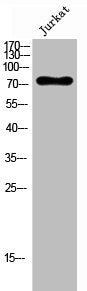 Western Blot analysis of Jurkat cells using PJA2 Polyclonal Antibody