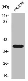 Western Blot analysis of COLO205 cells using PKA Iβ reg Polyclonal Antibody