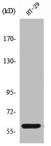 Western Blot analysis of HepG2 cells using PKM2 Polyclonal Antibody