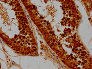 IHC image of CSB-PA003820LA01HU diluted at 1:300 and staining in paraffin-embedded human testis tissue performed on a Leica BondTM system. After dewaxing and hydration, antigen retrieval was mediated by high pressure in a citrate buffer (pH 6.0)....