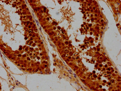 IHC image of CSB-PA003820LA01HU diluted at 1:300 and staining in paraffin-embedded human testis tissue performed on a Leica BondTM system. After dewaxing and hydration, antigen retrieval was mediated by high pressure in a citrate buffer (pH 6.0)....