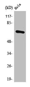 Western Blot analysis of Jurkat cells using PP2A-Aβ Polyclonal Antibody