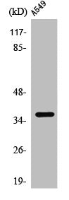 Western Blot analysis of A549 cells using PP2A-Cα Polyclonal Antibody
