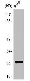 Western Blot analysis of HuvEc cells using PP32R1 Polyclonal Antibody