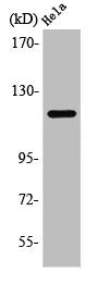 Western Blot analysis of HeLa cells using PR Polyclonal Antibody
