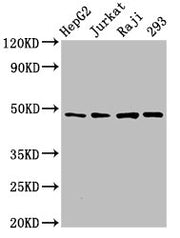 Western Blot Positive WB detected in: HepG2 whole cell lysate, Jurkat whole cell lysate, Raji whole cell lysate, 293 whole cell lysate All lanes: EIF4A2 antibody at 3µg/ml Secondary Goat polyclonal to rabbit IgG at 1/50000 dilution Predicted band...