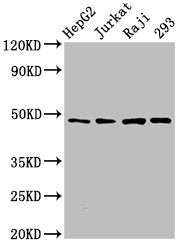 Western Blot Positive WB detected in: HepG2 whole cell lysate, Jurkat whole cell lysate, Raji whole cell lysate, 293 whole cell lysate All lanes: EIF4A2 antibody at 3µg/ml Secondary Goat polyclonal to rabbit IgG at 1/50000 dilution Predicted band...