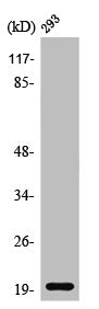 Western Blot analysis of HeLa cells using Probetacellulin Polyclonal Antibody