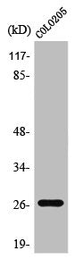 Western Blot analysis of Jurkat cells using PRSS33 Polyclonal Antibody