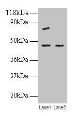 Western blot All lanes: EIF4A2 antibody at 2µg/ml Lane 1: EC109 whole cell lysate Lane 2: 293T whole cell lysate Secondary Goat polyclonal to rabbit IgG at 1/10000 dilution Predicted band size: 47 kDa Observed band size: 47 kDa