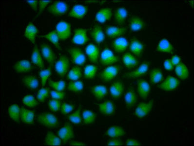 Immunofluorescence staining of Hela cells with CSB-PA003860LA01HU at 1:166, counter-stained with DAPI. The cells were fixed in 4% formaldehyde, permeabilized using 0.2% Triton X-100 and blocked in 10% normal Goat Serum. The cells were then incubat...