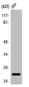 Western Blot analysis of 293 cells using Rab 35 Polyclonal Antibody