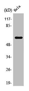 Western Blot analysis of HuvEc cells using Rabaptin-5β Polyclonal Antibody