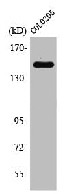 Western Blot analysis of COLO205 cells using Rad50 Polyclonal Antibody