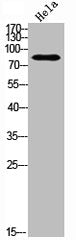 Western Blot analysis of Hela cells using Raf-B Polyclonal Antibody