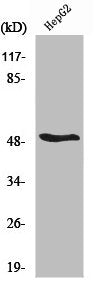 Western Blot analysis of HepG2 cells using RARβ Polyclonal Antibody