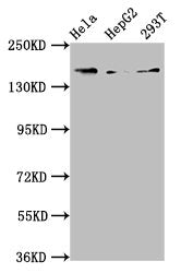 Western Blot Positive WB detected in: Hela whole cell lysate, HepG2 whole cell lysate, 293T whole cell lysate All lanes: C4A antibody at 3.9ug/ml Secondary Goat polyclonal to rabbit IgG at 1/50000 dilution Predicted band size: 193, 188 kDa Observe...