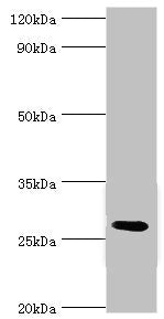Western blot All lanes: C4b-binding protein beta chain antibody at 6ug/ml + Mouse liver tissue Secondary Goat polyclonal to rabbit IgG at 1/10000 dilution Predicted band size: 28 kDa Observed band size: 28 kDa