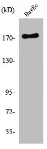 Western Blot analysis of HuvEc cells using Ret Polyclonal Antibody