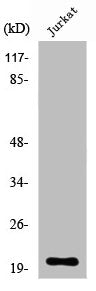 Western Blot analysis of Jurkat cells using RGS10 Polyclonal Antibody