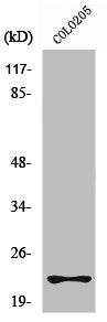 Western Blot analysis of A549 cells using Rho D Polyclonal Antibody