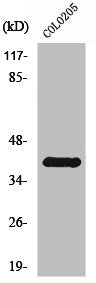 Western Blot analysis of COLO205 cells using Rhodopsin Polyclonal Antibody
