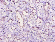 Immunohistochemistry of paraffin-embedded human kidney tissue using CSB-PA003995YA01PI at dilution of 1:10