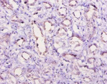 Immunohistochemistry of paraffin-embedded human kidney tissue using CSB-PA003995YA01PI at dilution of 1:10