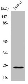 Western Blot analysis of Jurkat cells using Rit1 Polyclonal Antibody